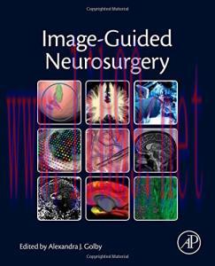 [AME]Image-Guided Neurosurgery