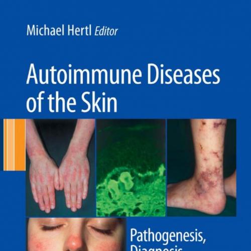 Autoimmune Diseases of the Skin_ Pathogenesis, Diagnosis, Management