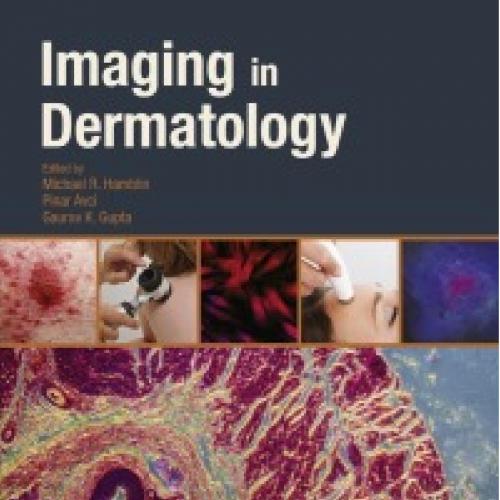 Imaging in Dermatology - Michael R. Hamblin - 4_8=8AB@0B_@
