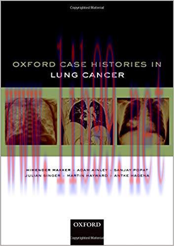 [PDF]Oxford Case Histories in Lung Cancer