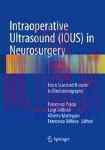 [PDF]Intraoperative Ultrasound (IOUS) in Neurosurgery: From_ Standard B-mode to Elastosonograph...