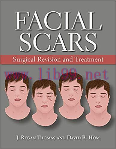 [PDF]Facial Scars: Surgical Revision and Treatment