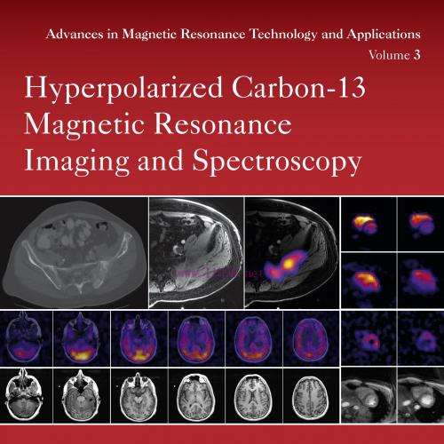[AME]Hyperpolarized Carbon-13 Magnetic Resonance Imaging and Spectroscopy (EPUB)