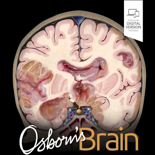 [AME]Osborn&rsquo;s Brain, 3rd Edition (EPub+Converted PDF)