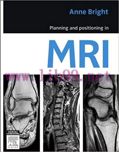(PDF)Planning and Positioning in MRI &ndash; E-Book 1st Edition
