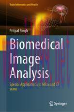 [PDF]Biomedical Image Analysis: Special Applications in MRIs and CT scans