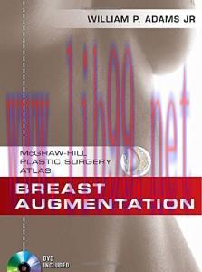 [AME]Breast Augmentation (McGraw-Hill Plastic Surgery Atlas) (ORIGINAL PDF from_ Publisher)