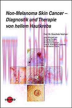 [AME]Non-Melanoma Skin Cancer - Diagnostik und Therapie von hellem Hautkrebs (UNI-MED Science) ...