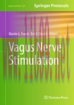 [PDF]Vagus Nerve Stimulation