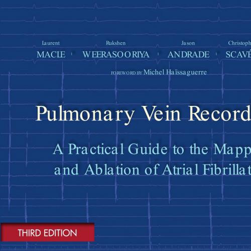 Pulmonary Vein Recordings 3rd Edition