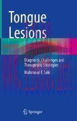 [PDF]Tongue Lesions: Diagnostic Challenges and Therapeutic Strategies
