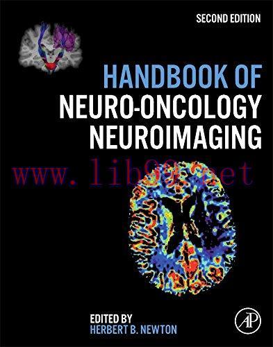 [AME]Handbook of Neuro-Oncology Neuroimaging, 2nd Edition (Original PDF)