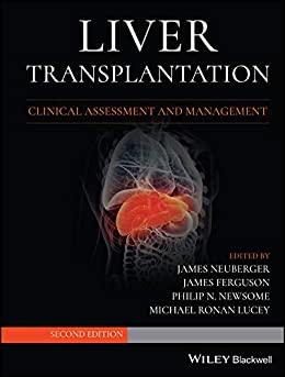Liver Transplantation Clinical Assessment and Management