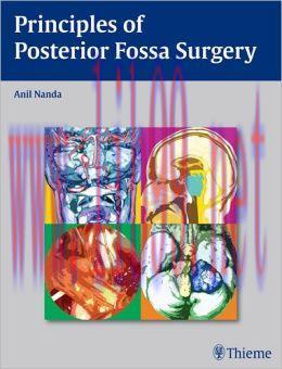 [AME]Principles of Posterior Fossa Surgery: Surgical Management