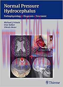 [PDF]Normal Pressure Hydrocephalus