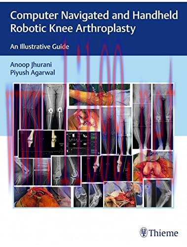 [AME]Computer Navigated and Handheld Robotic Knee Arthroplasty: An Illustrative Guide (Original...