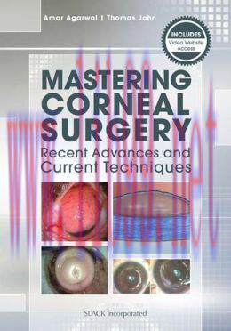 [AME]Mastering Corneal Surgery: Recent Advances and Current Techniques (ORIGINAL PDF from_ Publ...
