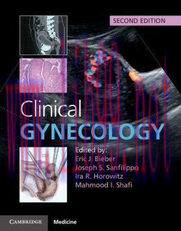 [AME]Clinical Gynecology, 2nd Edition