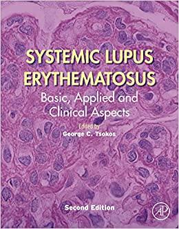 (PDF)Systemic Lupus Erythematosus Basic, Applied and Clinical Aspects