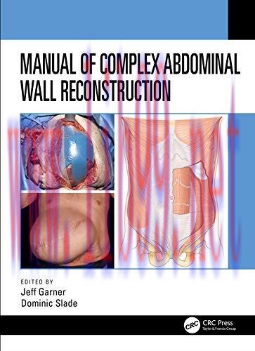 [AME]Manual of Complex Abdominal Wall Reconstruction (Original PDF)