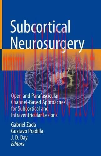 [AME]Subcortical Neurosurgery: Open and Parafascicular Channel-Based Approaches for Subcortical...