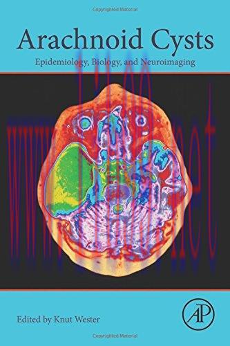 [AME]Arachnoid Cysts: Epidemiology, Biology, and Neuroimaging (PDF)