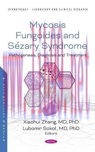 [AME]Mycosis Fungoides: Causes, Diagnosis and Treatment (Original PDF)