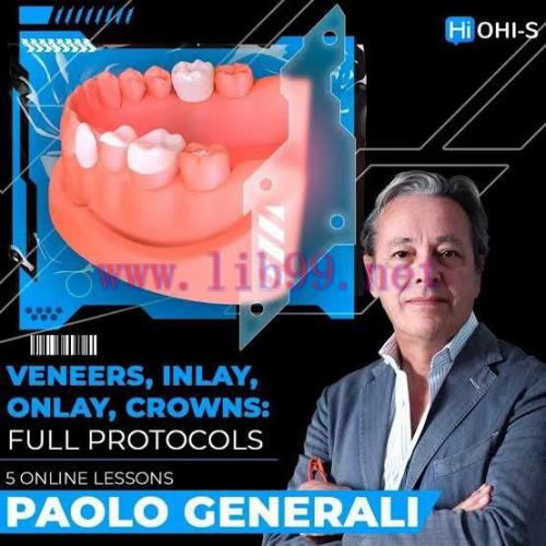 [AME]OHI-S Veneers, inlay, onlay, crowns: full protocols (Videos)