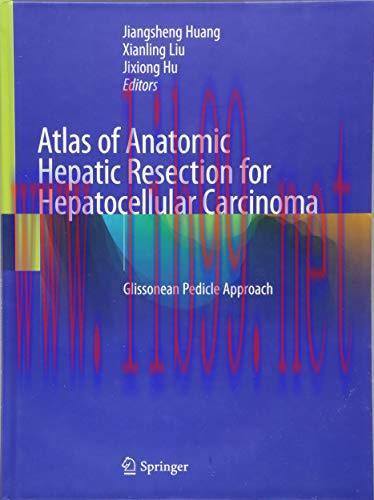[AME]Atlas of Anatomic Hepatic Resection for Hepatocellular Carcinoma: Glissonean Pedicle Appro...