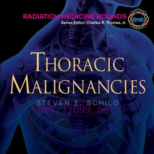 [AME]Thoracic Malignancies (EPUB)