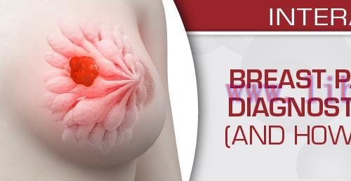 [AME]USCAP Breast Pathology for All Ages: Diagnostic Pearls and Pitfalls (And How to Stay Out o...