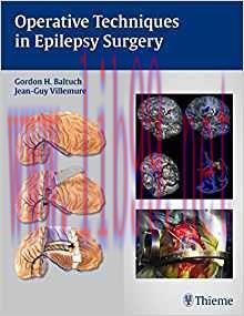 [PDF]Operative Techniques in Epilepsy Surgery
