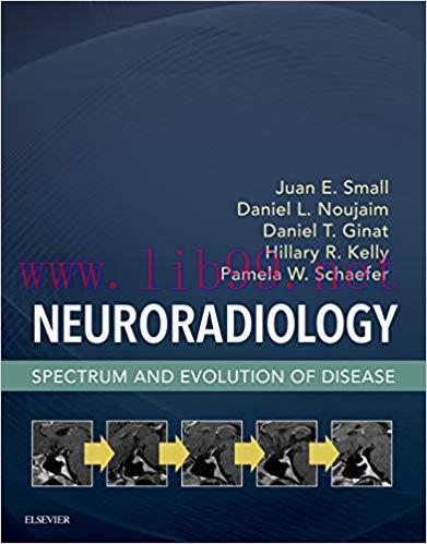 [PDF]Neuroradiology: Spectrum and Evolution of Disease