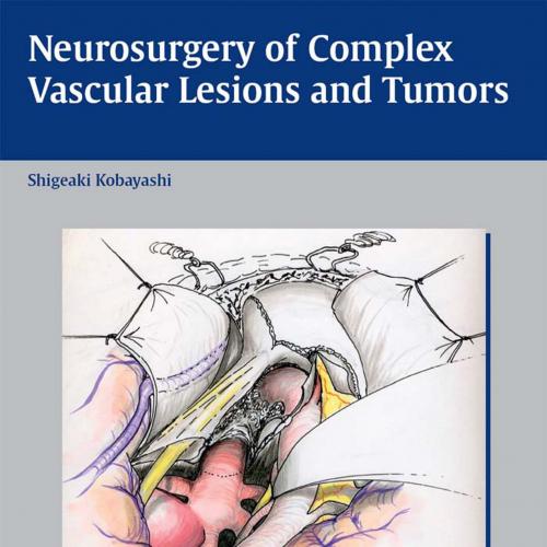 Neurosurgery of Complex Vascular Lesions and Tumors