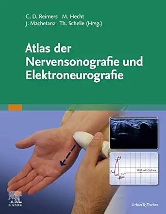 [AME]Atlas der Nervensonografie und Elektroneurografie (German Edition) (True PDF from_ Publish...