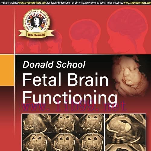 [AME]Donald School Fetal Brain Functioning (Original PDF)