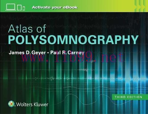 [AME]Atlas of Polysomnography (EPUB)
