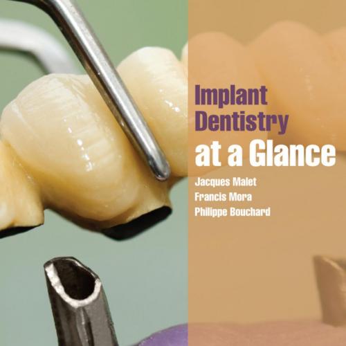 Implant Dentistry At-a-Glance