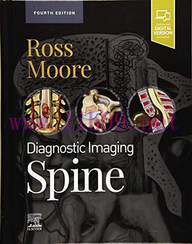 [AME]Diagnostic Imaging: Spine, 4th Edition (Original PDF)