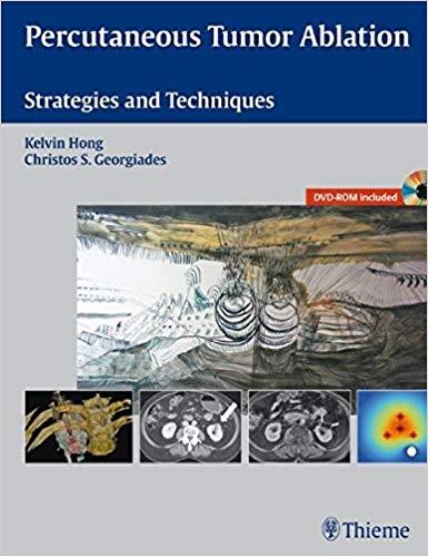 Percutaneous Tumor Ablation + Videos