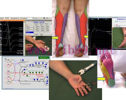 [AME]EMG/NCS Online Series: Volume III Sensory Nerve Conduction Studies (2nd Edition) (Videos)