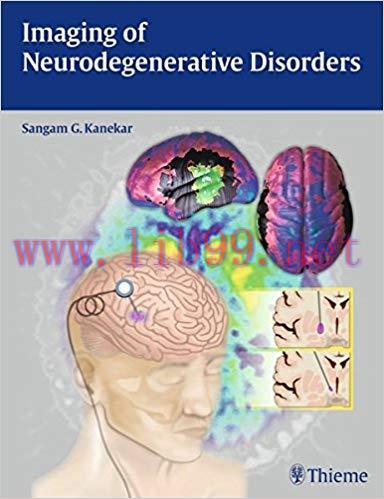 [PDF]lmaging of Neurodegenerative Disorders
