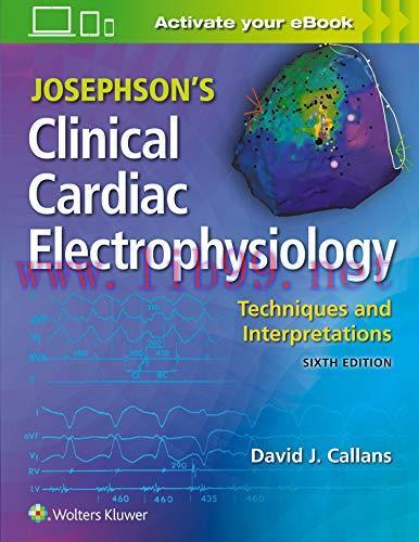 [AME]Josephson&rsquo;s Clinical Cardiac Electrophysiology: Techniques and Interpretations, 6ed (ePub)