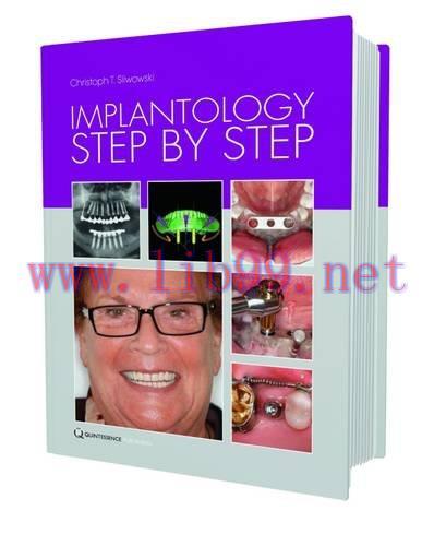 [AME]Implantology Step by Step (EPUB)