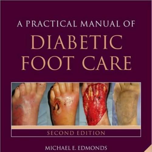 Practical Manual of Diabetic Foot Care, 2nd Second Edition (Praies), A - Michael E. Edmonds, Al...
