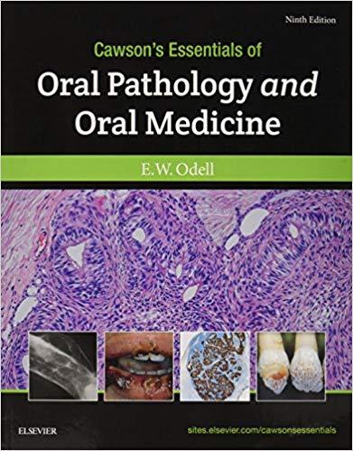 Cawson&rsquo;s Essentials of Oral Pathology and Oral Medicine 9th Edition