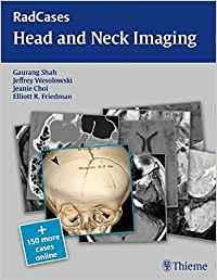 Head and Neck Imaging [RadCases]