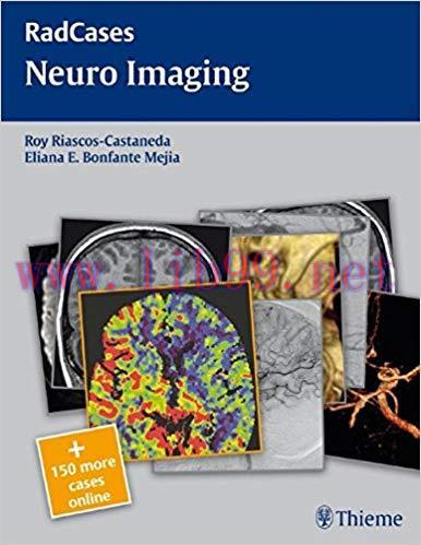 [PDF]Radcases Neuro Imaging