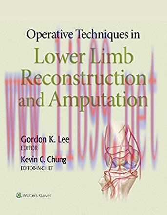 [Html]Operative Techniques in Lower Limb Reconstruction and Amputation