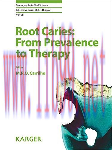 [AME]Root Caries: From_ Prevalence to Therapy (Monographs in Oral Science, Vol. 26) (PDF)